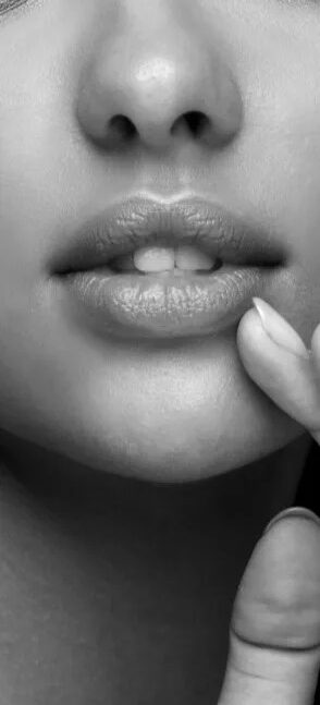 Lip lift in dubai
