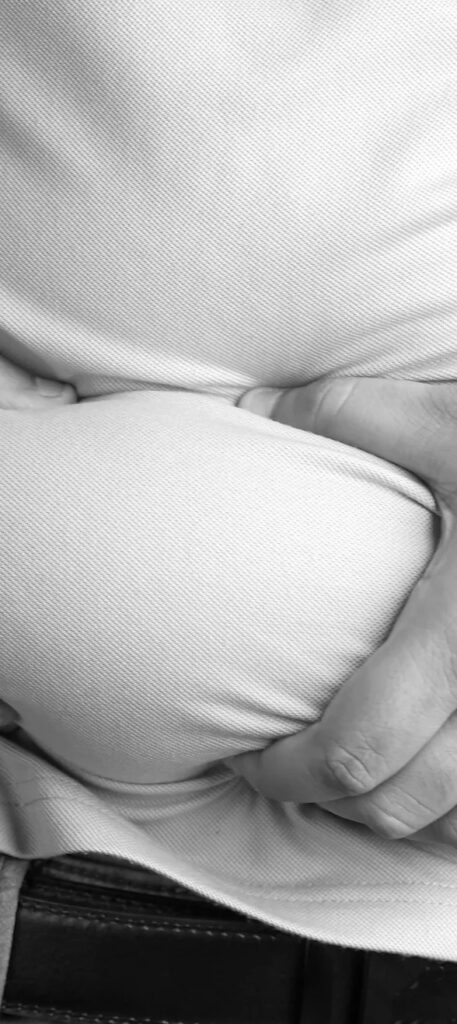 Abdominoplasty Dubai at Highness Clinics