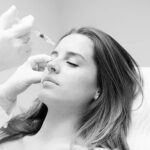 Botox Treatment