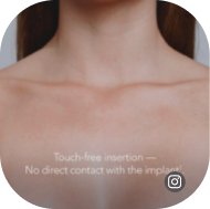 Mia Femtech Instagram Preview Breast Mia