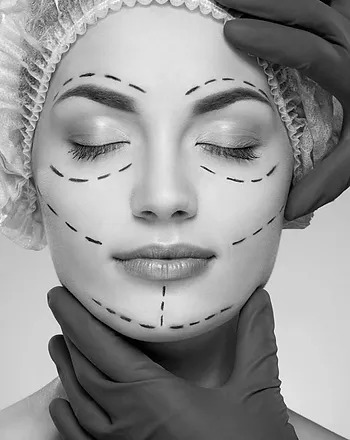 Cheek and Chin Implants dubai