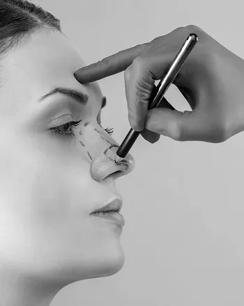 rhinoplasty in dubai